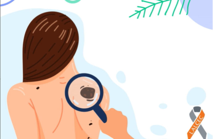 Campaña de prevención de cáncer de piel